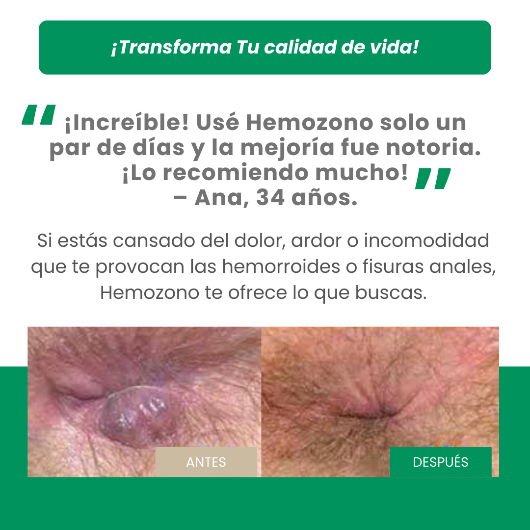 Aceite de Girasol Ozonizado para Zonas Sensibles - Hemozono = 155Mil Gs.