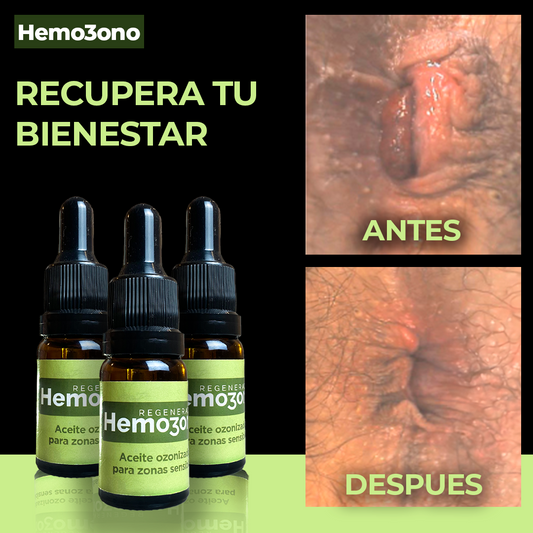 Hemozono | Aceite Ozonizado para Cuidado Natural de zonas sensibles = 155Mil Gs.